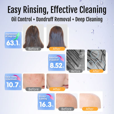 Gerador de bolhas nano ultra-finas para Spa e beleza Máquina de limpeza profunda da pele rica em hidrogênio e terapia de oxigênio